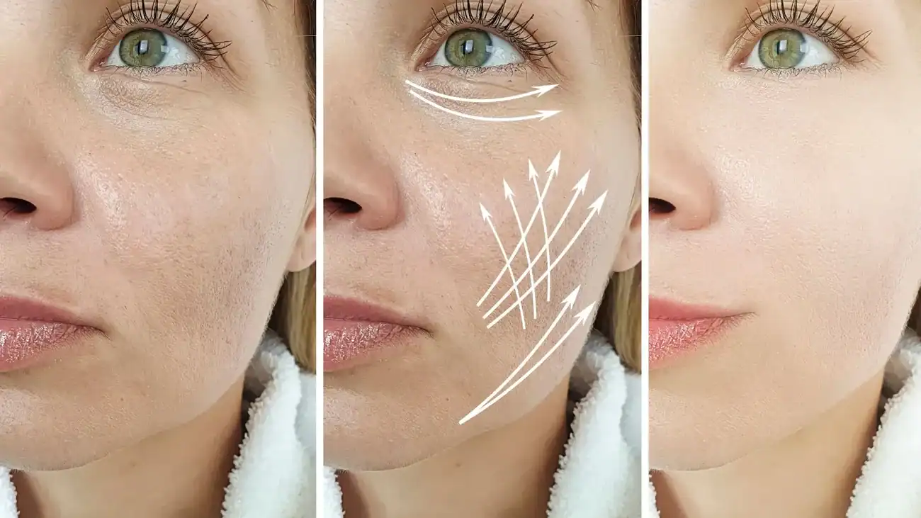 Can One Treatment Really Tackle More Than One Skin Concern Essex?
