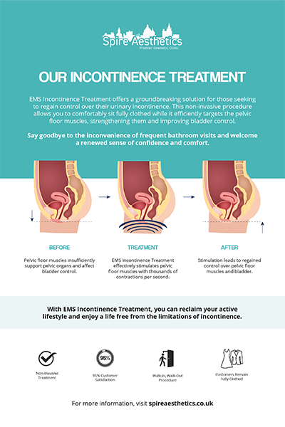 image to show how EMS treatment works for female urinary incontinence Essex